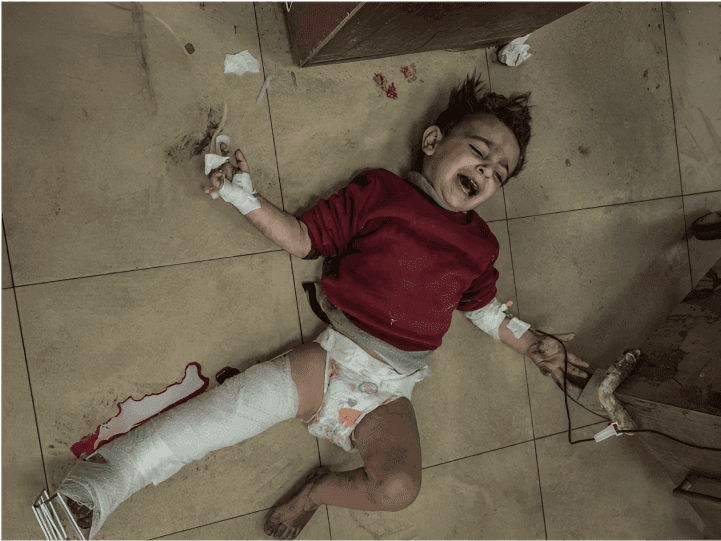 Injured Palestinian kid lying on the ground